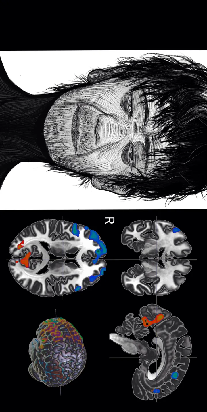 脑影像分析场景 · 人像与 MRI 拼贴
