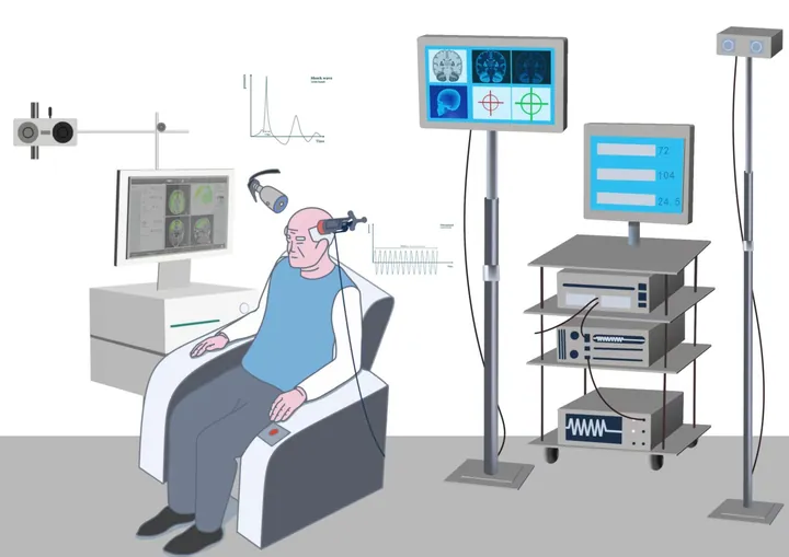 Transcranial magnetic stimulation illustrations