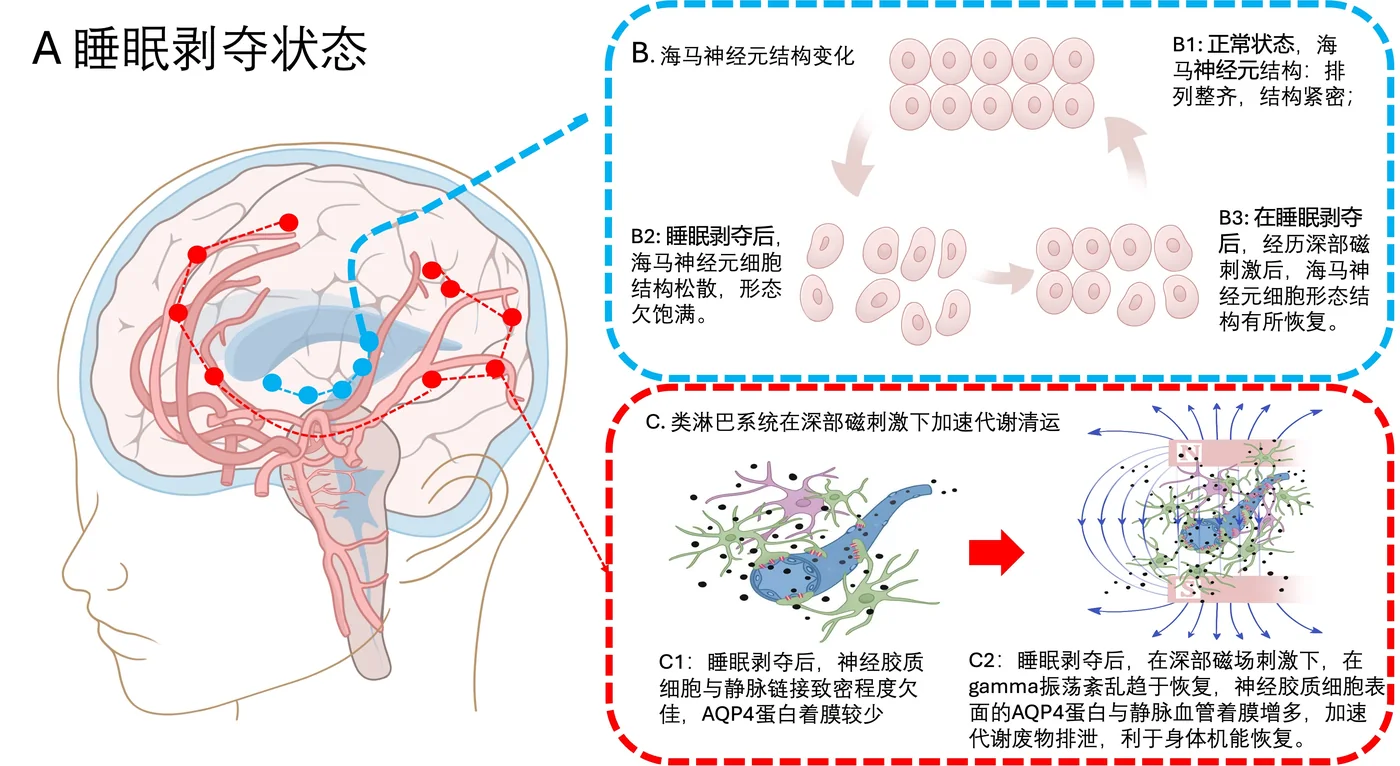 睡眠剝奪·海馬·類淋巴機制圖