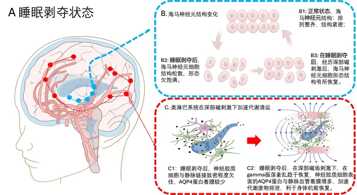 睡眠剝奪·海馬·類淋巴機制圖