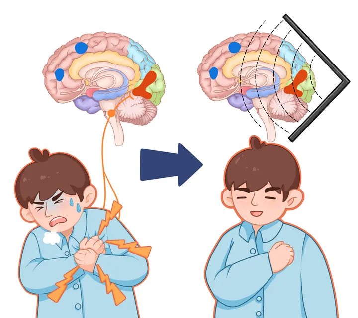 腦卒中對比示意 · 另一尺寸版